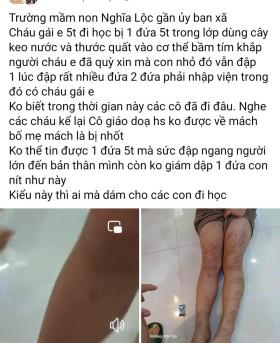 Sở Giáo dục & Đào tạo vào cuộc vụ 6 trẻ mầm non bị đánh 